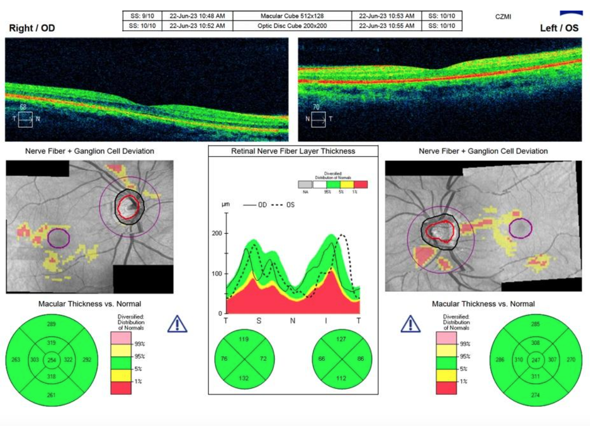 Lymm Eye Clinic - About Us